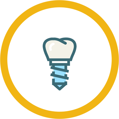 Graphic icon representing a dental implant